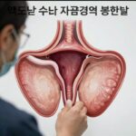 맥도날드 수술 자궁경부 봉합술 도식도