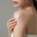 햇빛알레르기 피부 진정 루틴 햇빛알레르기로 붉어진 피부에 진정 크림을 바르는 모습