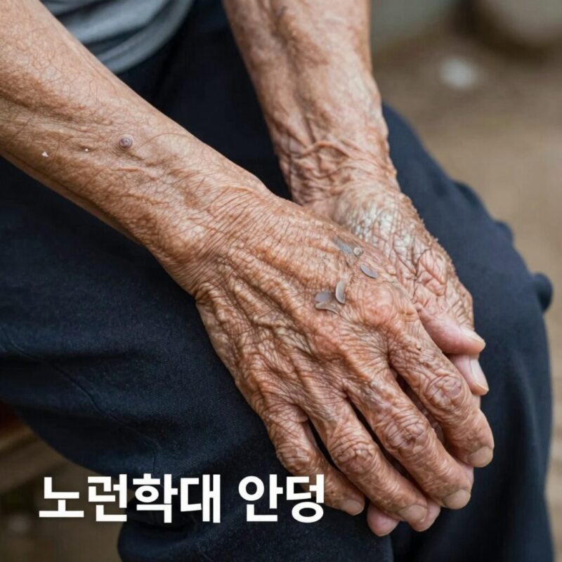 노인학대 예방의날, 신호와 대처 1 어르신 팔에 설명하기 어려운 멍이 있는 모습, 노인학대 의심 신호