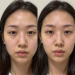 올리브영 6월 할인템 추천 리쥬란 듀얼 이펙트 앰플과 마스크 사용 전후 피부 변화 비교