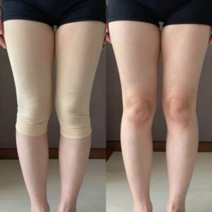 무릎 위 5cm 반바지와 너무 짧은 반바지 비교 이미지로 체형 커버 차이를 보여줌