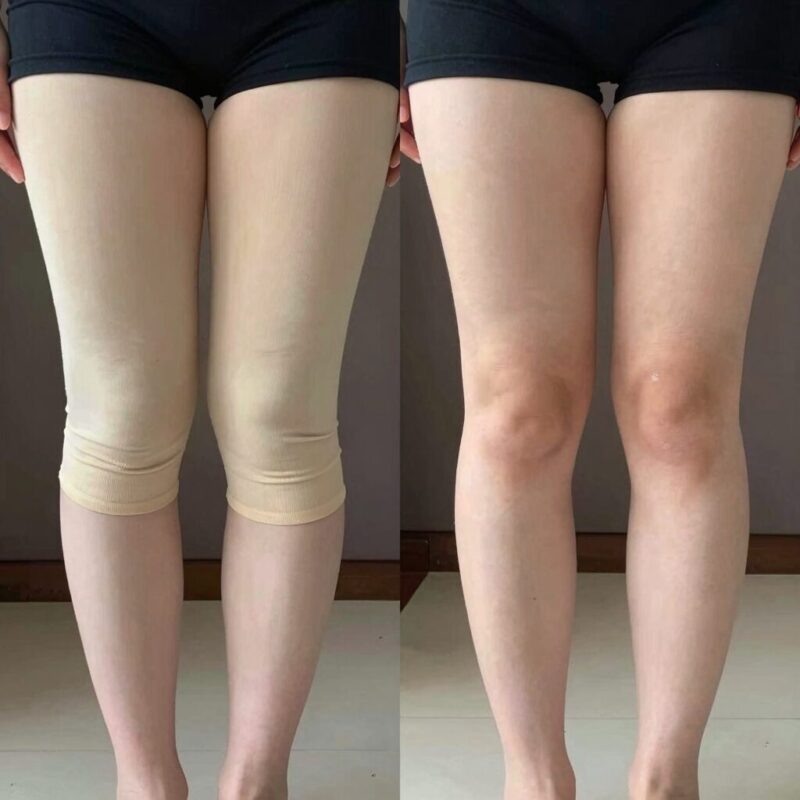여름 반바지 선택과 관리 완벽 정리 1 무릎 위 5cm 반바지와 너무 짧은 반바지 비교 이미지로 체형 커버 차이를 보여줌