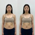 서인영 지방흡입 수술 효과와 관리 서인영 지방흡입 수술 전후 몸매 비교 이미지