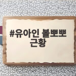 유아인 볼뽀뽀 근황