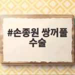 손종원 쌍꺼풀 수술 했나요 달라진 눈매 논란 총정리 손종원 쌍꺼풀 수술