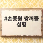 손종원 쌍꺼풀 성형